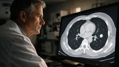 Lungenknoten im CT: was ein Zufallsbefund bedeutet und wann Kontrolle sinnvoll ist